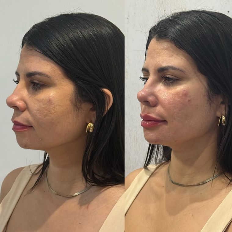Antes e depois em vista de três quartos